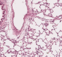 Photo de poumon sain vu au microscope